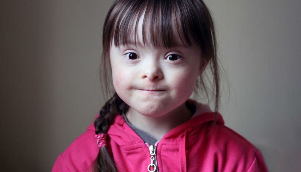 Down syndrome symptoms